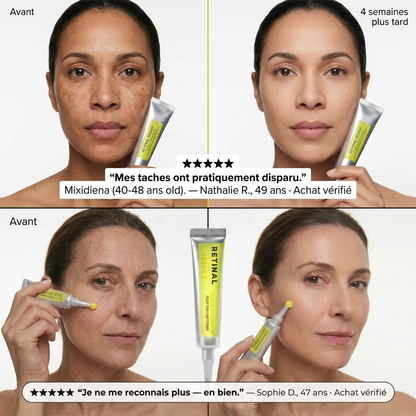 Anti-Fatigue Absolu — Le secret coréen pour un regard reposé